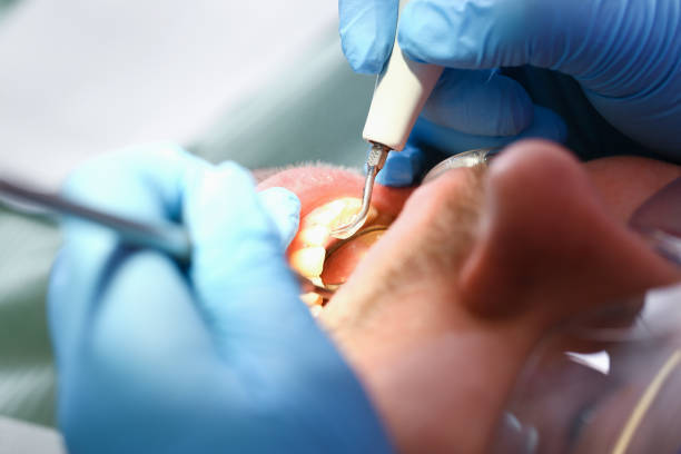 Best Emergency Dental Services for Seniors in Garberville, CA