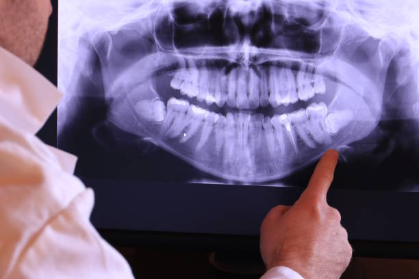 Best Holiday Emergency Dentist in Garberville, CA