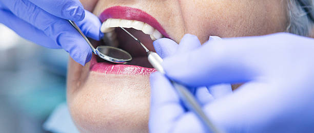Best Emergency Dental Care for Abscessed Tooth in Garberville, CA